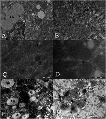 Figure 5. (A) Lipid droplets, (B) melting of the structure of the mitochondrial cristae in the liver sections from Group II, (C and D) normal mitochondria and small lipid droplets in Group III, (E) lipid droplets in Group IV, (F) lipid droplets and swollen mitochondria in hepatocytes from Group V.