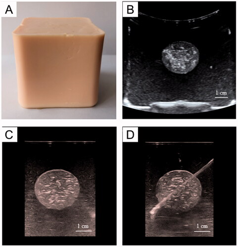 Figure 5. US imaging of the phantom model: A: Gross specimen of the phantom model. B, C: the US images illustrate the tumor embedded in normal tissue phantom (B: 3.5-5.0 MHz convex array probe, C: 7.5 MHz linear array probe). D: the US image of puncture needle that was advanced into the tumor.