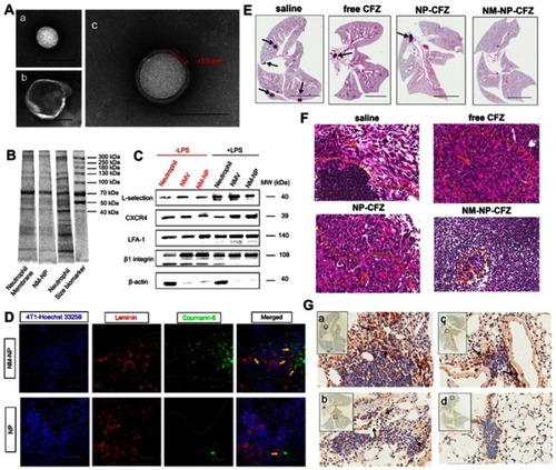 Figure 6 (A) TEM images of (a) bare PLGA NPs, (b) NMVs, and (c) NM-NPs. Scale bar is 100 nm. (B) SDS-PAGE protein tracking of the neutrophils membrane, NM-NPs, and neutrophils, respectively. (C) Western-blot identiﬁcation of membrane-associated adhesive proteins with and without LPS stimulation. (D) Confocal microscopy analysis of NPs targeting pre-metastatic region in a mouse model (n=3). The injected NPs and NM-NPs were labeled with coumarin-6 (coumarin-6 dosage of 1 mg/kg). Scale bar, 50 μm. (E) H&E staining pictures of lung tissues after mice were treated with saline, free CFZ, NP-CFZ, and NM-NP-CFZ, respectively. Arrows points out metastatic nodules. Scale bar, 5 mm. (F) Histological analysis of cancer cells inﬁltration in lymph node after the same treatment in (E), n=3. Scale bar, 100 μm. (G) The evaluation of the ability of NM-NP-CFZ, NP-CFZ, and free CFZ to inhibit neutrophils recruitment in mice lungs by immunological staining with S100A9 (brown), n=3. The lung tissues are in accordance with (E). Arrows were pointed to S100A9-positive cells. S100A9 is a cytoplasm protein secreted by neutrophils at the site of inﬂammation. Scale bar, 100 μm. Reprinted with permission from Kang T, Zhu Q, Wei D, et al.Nanoparticles coated with neutrophil membranes can effectively treat cancer metastasis. ACS Nano. 2017;11:1397–1411. doi:10.1021/acsnano.6b06477. Copyright 2017 American Chemical Society.Citation36Abbreviations: NMV, Neutrophil-derived membrane vesicles; NM-NP, neutrophil-mimicking nanoparticle; CFZ, carﬁlzomib.