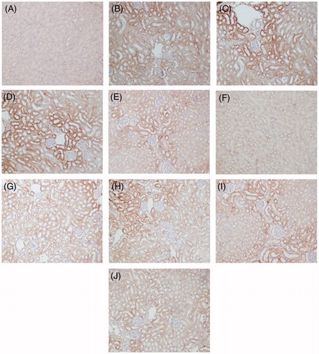 Figure 8. C5b-9 expression in kidney (immunohistochemistry). (A) Blank control group; (B–E) TCE + group at 24 r, 48 h, 72 h and Day 7, respectively; (F) solvent control group; (G–J) PKSI + group at 24 h, 48 h, 72 h and Day 7, respectively. Magnification = 400×.