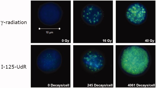 Figure 1. Representative images of γ-H2AX immuno-stained SCL-II cells after exposure to γ-radiation or I-125-UdR taken by a confocal laser scanning microscope. Exposure was carried out in frozen cells. Cells were PFA-fixed 30 min after thawing and subsequently immuno-stained (Anti-phospho-histone H2AX (139) clone JBW301; Alexa Fluor 488 goat anti-mouse IgG (H + L); DAPI).