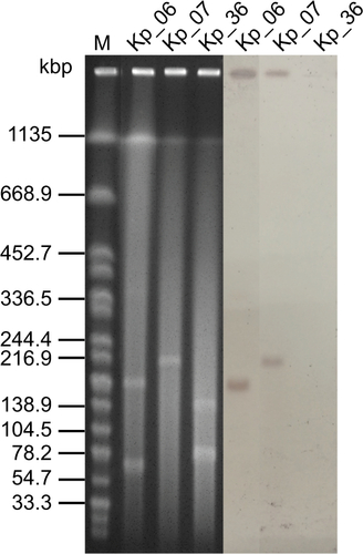 Figure S1 S1-PFGE and southern hybridization analysis of the K. pneumoniae strains.Notes: S1 nuclease digestion of total DNA of K. pneumoniae isolates was followed by PFGE. Plasmid bands are shown as linearized fragments on the gel. The presence of the virulence plasmid was confirmed by hybridizing with the rmpA2 probe. Lane M, reference standard strain Salmonella serotype Braenderup H9812 restricted with Xbal.Abbreviations: K. pneumoniae, Klebsiella pneumoniae; M, marker; PFGE, pulsed-field gel electrophoresis.