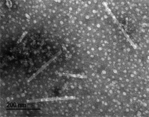 Fig. 5 Rod-shaped particles of wasabi mottle virus captured with a Hitachi H-7100 transmission electron microscope (100 kv) and Gatan Digital Micrograph software (v. 2.31.734.0; Gatan Inc., Pleasanton, CA, USA) after staining with uranyl acetate
