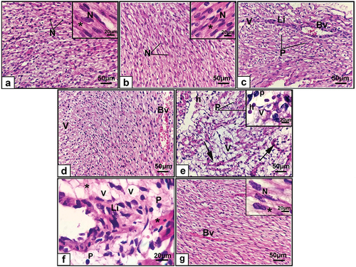 Figure 5. Photomicrographs of sections of the cardiac muscle of 20-day-old fetuses. (a) Control, (b) Ashwagandha, (c-f) Cloz, and (g) Cloz + ashwagandha groups.