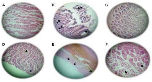 Figure 2 H&E staining of stomach of control and experimental animals. (A) Negative control: normal stomach ×400. (B) NMU, as presented by arrows: (a) structural disorder, (b) anaplastic cells, (c) hyperplasia in apex, ×400. (C) OR group: normal stomach, (H&E) ×400. (D) NMU + OR-100: dysplasia and recovery (arrows), (H&E) ×400. (E) NMU + OR-200: stomach with hypertrophy, no anaplastic figures (arrows): (H&E) ×400. (F) NMU + OR-300: stomach with atrophy (arrows): (H&E) ×400.