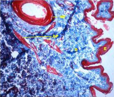 Figure 7. Epidermis(E), Dermis(D) and Presence of hair follicle (HF), Arrector pilli muscles (AP) in dermis in Masson's Tricrome stain X 100.