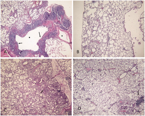 Figure 5. Histopathological findings (H&E) × 100 in lung tissue. (A) BLM, arrows indicate a thickening of interalveolar septum and formation of fibrous mass, asterisk indicates severe inflammation with the presence of large follicles which replace the parenchyma; (B) RO; (C) BLM/RO1, arrows point to a considerable interstitial thickening, but not that of alveolar walls; (D) BLM/RO2, arrows indicate slightly thickened walls without an apparent impairment to lung architecture. One representative example is shown for each group.