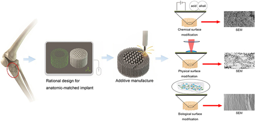 Figure 4 3D-printed Ti surface modification technologies: physical, chemical, and biological surface modification technologies. Reprinted from J Mech Behav Biomed Mater, Vol 105, Li J, Cui X, Hooper et al, Rational Design, Bio-functionalization and Biological Performance of Hybrid Additive Manufactured Titanium Implants for Orthopaedic Applications: A review, 103,671, Copyright © 2020, with permission from Elsevier;.Citation72 Reprinted from Applied Surface Science, Vol 480, Surmeneva M, Lapanje A, Chudinova et al, Decreased Bacterial Colonization of Additively Manufactured Ti6Al4V Metallic Scaffolds with Immobilized Silver and Calcium Phosphate Nanoparticles, 822–829, Copyright © 2019, with permission from Elsevier.Citation73 Reprinted from Sheng X, Wang A, Wang Z, Liu H, Wang J, Li C. Advanced Surface Modification for 3D-Printed Titanium Alloy Implant Interface Functionalization. Front Bioeng Biotechnol. 2022;10:850,110. Creative Commons;Citation50 Reprinted from Soyama H, Takeo F. Effect of Various Peening Methods on the Fatigue Properties of Titanium Alloy Ti6Al4V Manufactured by Direct Metal Laser Sintering and Electron Beam Melting. Materials (Basel). 2020;13(10). Creative Commons;Citation74 Reprinted from Mieszkowska A, Beaumont H, Martocq et al. Phenolic-Enriched Collagen Fibrillar Coatings on Titanium Alloy to Promote Osteogenic Differentiation and Reduce Inflammation. Int J Mol Sci. 2020;21(17). Creative Commons.Citation75