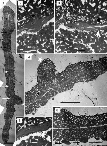 Plate 5. Megaspore ultrastructure of Biharisporites sp. 1, specimen 409-3 (Lower Permian of the Rajmahal Basin, India), all photomicrographs taken with a transmitted electron microscope. 1. Composite image of the section showing the sporoderm, the apertural region (asterisk), and cavities between the inner and outer layers of the distal sporoderm (white arrows) and between the proximal and distal face of sporoderm in the equatorial part of the megaspore (black arrows). 2. Enlargement of figure 1 showing a laminated zone probably cut in its central part (black asterisk). 3. Enlargement of figure 1 showing a laminated zone presumably cut at its periphery (gray asterisk), and the distal (white arrowhead) and the proximal (black arrowhead) parts of the inner layer. 4. The apertural region (asterisk). The black arrow points to a laminated zone presumably cut at its central area, the gray arrow points to a laminated zone presumably cut in its periphery. 5. Enlargement of figure 1 showing thickness of the distal (white arrow) and the proximal (black arrow) parts of the inner layer. 6. Fragment of the section showing the structure of sculptural elements (black arrows). Scale bar: 1, 4 = 20 µm; 2, 5 = 1 µm; 3 = 2 µm; 6 = 10 µm.