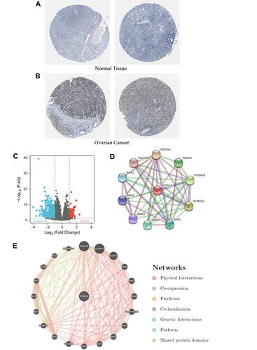 Figure 2 The protein expression of SCNN1A in ovarian cancer, SCNN1A-related differentially expressed genes (DEGs) and SCNN1A-correlated proteins and genes. (A and B) The protein levels of SCNN1A in normal ovarian tissue and OV based on Human Protein Atlas. (C) Volcano plot of DEGs between the high- and low-SCNN1A expression groups. (D) The protein–protein interaction network of SCNN1A via STRING. (E) The gene–gene interaction network of SCNN1A via GeneMania.