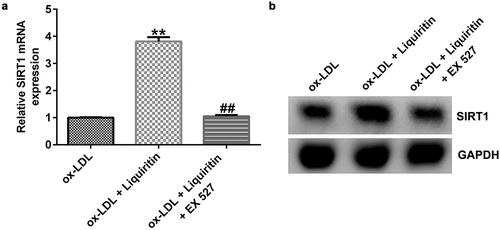 Figure 5. EX 527 inhibits the increase of SIRT1 expression induced by liquiritin in ox-LDL-induced hVSMCs. hVSMCs were treated with 80 μM liquiritin or/and 10 μM EX 527 in the presence of 100 μg/mL ox-LDL for 24 h. (a) The mRNA expression of SIRT1 in ox-LDL-induced hVSMCs was detected by RT-qPCR analysis. The fold change calculated against ox-LDL group. (b) The protein expression of SIRT1 in ox-LDL-induced hVSMCs was detected by Western blot analysis. **P < 0.01 vs. ox-LDL; ## P < 0.05, 0.01 vs. ox-LDL+liquiritin group.