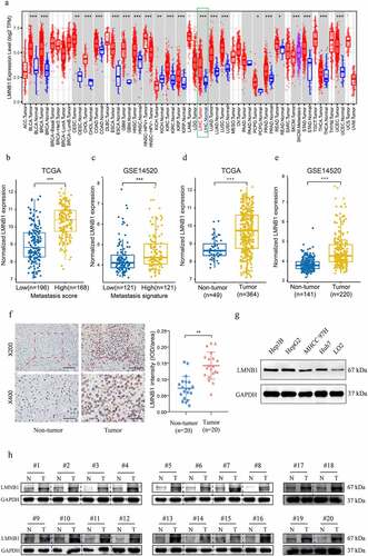 Figure 3. Expression analysis of LMNB1 in HCC. (a) LMNB1 was abnormally expressed in different malignancies in the TIMER2 database. (b) LMNB1 was upregulated in patients with high metastasis scores. (c) LMNB1 was upregulated in patients with high metastasis signatures. (d, e) In the GSE14520 dataset (d) and TCGA-LIHC dataset (e), LMNB1 was overexpressed in HCC compared to peritumoral tissues. (f) Representative IHC images of HCC tissues and peritumoral tissues. IHC verified that LMNB1 was overexpressed in HCC. Scale bars (up) = 100 μm. Scale bars (low) = 50 μm. (g) Overexpression of LMNB1 was detected in HCC cell lines. (h) Western blot analysis of HCC tissues and peritumoral tissues. *P < 0.05, **P < 0.01, ***P < 0.001.