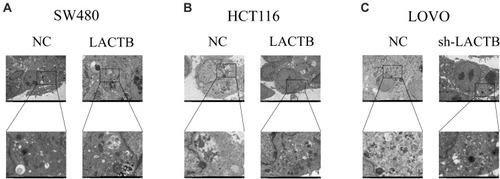 Figure 5 Effects of LACTB on autophagosomes in CRC cells. (A–B) Autophagosomes were observed in CRC cells by TEM. Additionally, in LACTB-overexpressing HCT116 and SW480 cells exhibited higher levels of autophagosomes compared with the control cells. (C) The inhibition of LACTB expression in LOVO cells decreased the numbers of autophagosomes. Magnification, 1500× and 5000×.