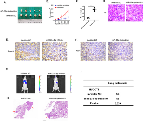 Figure 4. Decreasing miR-23a-3p expression could inhibit growth, as well as metastasis of tumor in vivo. (a) The image of tumor in miR-23a-3p inhibitor as well as inhibitor NC groups. (b) The tumor growth curve when miR-23a-3p been knockdown. (c) The average tumor weight when miR-23a-3p been knockdown. (d) HE staining of subcutaneous tumors. (e) Detected PanCK protein using IHC staining of subcutaneous tumors. (f) Down-regulation of Ki-67 in miR-23a-3p inhibitor group in comparison to inhibitor NC group. (g-i) Lung metastasis and HE staining results of tumor when miR-23a-3p been knockdown.