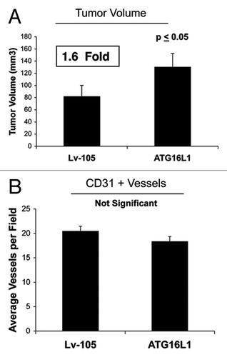 Figure 7. Fibroblasts overexpressing ATG16L1 drive enhanced tumor growth, without a measurable increase in angiogenesis.(A) In vivo, ATG16L1-fibrolasts also promoted tumor growth, resulting in an ~1.6-fold increase in tumor volume, relative to control fibroblasts. n = 10 per experimental group. (B) Increases observed in tumor growth were independent of tumor angiogenesis, as we previously observed for BNIP3, and CTSB. Lv-105 represents fibroblasts transduced with the vector alone control, namely Lv-105 (puro).