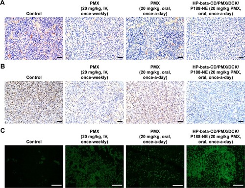 Figure 11 Representative cross-sectional images of isolated tumor tissues stained with (A) anti-CD31 antibody for microvessels (brown), (B) PCNA for proliferating cells (brown), and (C) TUNEL for apoptosis (green fluorescence) in the tumor tissues taken 21 days after treatment with once-weekly IV administration of PMX (20 mg/kg) and once-daily oral administration of PMX in aqueous solution (20 mg/kg) or HP-beta-CD/PMX/DCK/P188-NE (equivalent to 20 mg/kg PMX) for 21 days.Notes: Scale bar represents 50 μm. HP-beta-CD/PMX/DCK/P188, ion-pairing complex between PMX and DCK containing HP-beta-CD and P188; HP-beta-CD/PMX/DCK/P188-NE, HP-beta-CD/PMX/DCK/P188-loaded nanoemulsion. Magnification for images in (A) and (B) ×20. Magnification for images in (C) ×40.Abbreviations: DCK, Nα-deoxycholyl-l-lysyl-methylester; HP-beta-CD, 2-hydroxypropyl-beta-cyclodextrin; IV, intravenous; PCNA, proliferating cell nuclear antigen; PMX, pemetrexed; P188, poloxamer 188; TUNEL, terminal deoxynucleotidyl transferase dUTP nick end labeling.