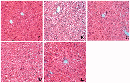 Figure 3. Histological examination of liver in HE staining. (A) Normal; (B) control diabetic; (C) diabetic + TGP 50 mg/kg; (D) diabetic + TGP 100 mg/kg; (E) diabetic + TGP 200 mg/kg. Original magnification 100×.