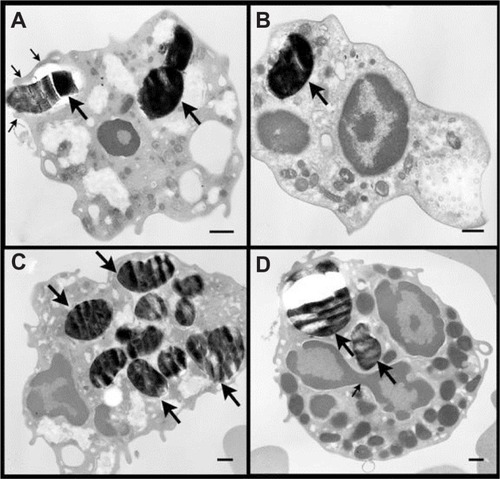 Figure 2 Transmission electron microscopic images of fetal white blood cells incubated with 500 μg/mL MCM41-cal for 2 hours. The number of MCM41-cal (big arrows) inside the cells varied (Panels A–D). Panel A shows MCM41-cal inside the cytosol of a macrophage (large arrow) and another particle being engulfed by extended pseudopods (thin arrows). Panel D shows two MCM41-cal particles (big arrows) in the cytosol of a basophil; note the three lobes of the nucleus with a connecting strand (thin arrow) and large granules.Note: Scale bar = 0.5 μm.
