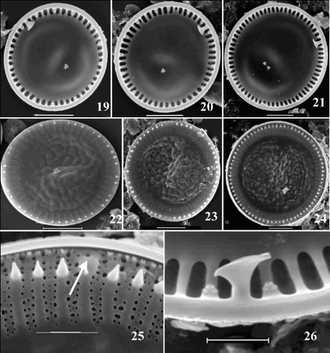 Figs 19–26. SEM images of valves of the ‘extreme’ morph of Cyclotella scaldensis. Figs 19–21. Valve interiors. Figs 22–24. Valve exteriors over the size range. Fig. 25. Exterior margin, showing process openings; RP opening marked by an arrow. Fig. 26. Interior margin with RP and two neighbouring FPs. Scale bars represent 5 µm (Figs 19–24) and 2 µm (Figs 25, 26).