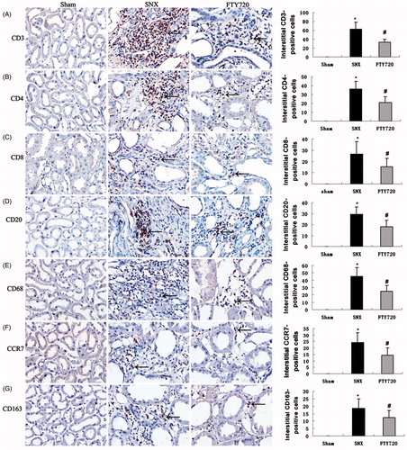 Figure 4. Effects of FTY720 on tubulointerstitial staining of T cells (CD3), T cell subtypes (CD4, CD8), B cells (CD20), macrophages (CD68) and macrophage subtypes (CCR7/M1, CD163/M2). FTY720 treatment significantly reduced the number of the interstitial infiltration of CD3-positive (A), CD4-positive (B), CD8-positive T cells (C), CD20-positive B cells (D), CD68-positive (E), CCR7-positive (F) and CD163-positive macrophages (G) in the SNX rats. Original magnification: ×400. Data are presented as the mean ± SD, n = 8, *p < 0.01 versus sham, #p < 0.01 versus SNX.