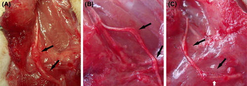 Figure 3. Observation of the newly regenerated nerve in each group by the naked eye. The transplanted nerve grew well in each group, and a thickening was observed. Many newly generated tissues appear in the surrounding area. The diameter observed by the naked eye achieved or even exceeded that of the normal peroneal nerve; however, hyperplasia at the anastomoses was more obvious (black arrows). It can be seen that the chitin tube at the distal anastomosis of group C has not been fully absorbed, and the newly generated nerve tissue through the sleeve bridging technique can be observed (white arrow). (A) the in situ graft group; (B) the adventitial suture group; (C) the sleeve suture group.