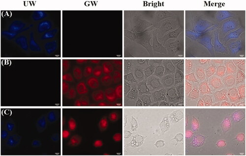 Figure 7. Fluorescence microscopy images of HepG-2 cells incubated with HA-ss-ATRA/TPENH2 HNPs (A), free DOX (B) and DOX-loaded HA-ss-ATRA/TPENH2 HNPs (C) for 8 h. For each panel, left to right show the UW, GW, bright and merge field images. Scale bars correspond to 10 μm in all the images.