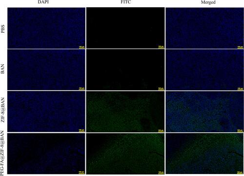 Figure 10 TUNEL stained images of tumor tissue in treated mice (scale bar: 100 μm).