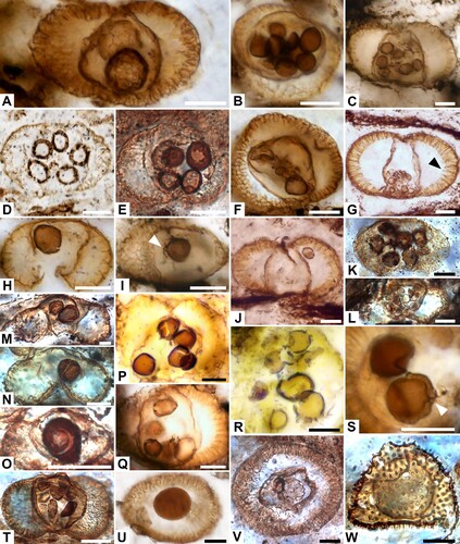 Figure 2. Illustrations of chytrid- or oomycete-like remains within bisaccate glossopterid pollen (A–T), monosaccate cordaitalean pollen (U, V) and a trilete fern spore (W) preserved in permineralised peat from the uppermost bed of the Toploje Member, Bainmedart Coal Measures, Amery Group (Type 1 bodies in A–T; Type 2 bodies in U–W). A. Two spherical bodies with weakly reticulate ornamentation in pollen corpus; PCM2B; S089895-01. B. Eight smooth bodies in corpus of obliquely sectioned pollen grain; PCM3; S089923-01. C. Eight smooth bodies in pollen corpus; PCM3B; S089909-01. D. Bodies with weakly ridged (reticulate?) ornamentation in pollen corpus; PCM8; S088064(A)-02. E. Four smooth elliptical bodies in pollen corpus; PCM1; S088061-02. F. Bodies of varied size in corpus of pollen in oblique section; PCM3B; S089909-01. G. Aggregation of small bodies on one side of pollen corpus; arrow indicates infraexinal ramifications extending towards, but not filling, saccus chamber; PCM2B; S090342. H. Solitary body in pollen corpus; PCM2B; S089895-01. I. Solitary body with pore and possible bore and tubular extension in pollen corpus (arrowed); PCM3B; S089909-01. J. Elliptical body in pollen saccus; PCM2C; S090344. K. Six bodies in corpus of degraded pollen; PCM8; S088064(A)-02. L. At least ten small bodies in pollen corpus; PCM3B; S090343. M. Two bodies in pollen corpus; PCM1; S089892-02. N. Solitary smooth cleft body in pollen corpus; PCM3B; S090343. O. Solitary body with crescentic fracture in pollen corpus; PCM1; S124943-02. P. Smooth-walled and cleft bodies in pollen corpus; PCM2B; S088072-03. Q. Thin-walled bodies in pollen corpus; PCM3B; S089909-01. R. Ragged bodies in pollen corpus; PCM2B; S088072-03. S. Spherical bodies, one with possible pore and tubular extension (arrowed) in pollen corpus; PCM2B; S088072-03. T. Elliptical to irregularly distorted bodies in pollen corpus; PCM2A; S090345. U. Large dark body in pollen centre; PCM3; S089923-01. V. Thin-walled degraded body in centre of pollen grain; PCM1; S088061(A)-03. W. Large spherical body with darkened rim in spinose spore; PCM1; S089892-02. Scale bars ‒ 20 µm. A–C, E–W = thin sections; D = cellulose acetate peel.