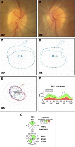 Figure 3 Patient 3.