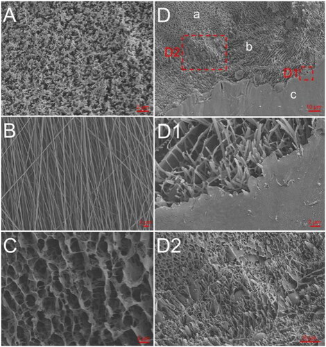 Figure 1. Cryo-SEM and SEM analyses. (A) Cryo-SEM of Rg3-H. (B) SEM of 5-Fu-F. (C) Cryo-SEM of H-PA. (D) Cryo-SEM of Rg3-H/5-Fu-F/H-PA; a, b, and c represent Rg3-H, 5-Fu-F, and H-PA, respectively; D1 and D2 denote the boundary interfaces of 5-Fu-F/H-PA and Rg3-H/5-Fu-F, respectively.