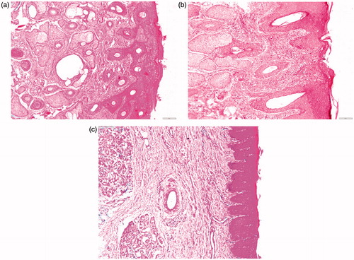 Figure 4. Photomicrographs of the anterior segments of sheep nasal mucosa treated with pH 6.4 PBS (negative control, a), isopropyl alcohol (positive control, b), and CZ-loaded polymeric micelles (c) (100×).