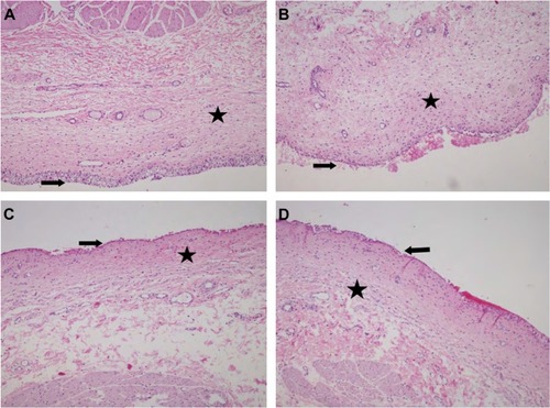 Figure 5 Microscopic images of bovine bladder mucosa.Notes: Healthy bladder mucosa (A); bladder mucosa treated with chitosan–TGA NPs (B); bladder mucosa treated with NP-loaded chitosan gel (C); bladder mucosa treated with NP-loaded Plx gel (D). ➔, urothelium, and ★, lamina propria. H&E staining; magnification ×40.Abbreviations: TGA, thioglycolic acid; NP, nanoparticle; Gem-HCl, gemcitabine hydrochloride; Plx, poloxamer; H&E, hematoxylin eosin.