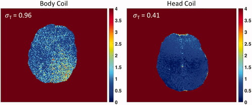 Figure 8. Temperature uncertainty in the brains of two volunteers using the volume body coil (left) and tcMRgFUS head coil (right). The σT is calculated as the spatial average of the standard deviation across the brain. Uniformity and σT is improved using the head coil (Body Coil σT = 0.96 °C ± 0.55 °C, and Head Coil σT = 0.41 °C ± 0.24 °C).