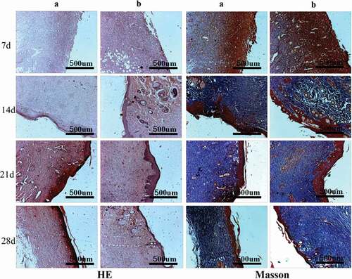 Figure 13. The HE/Masson staining of wound areas treated by PVA-COL-1 and blank group(A: Blank group B: PVA-COL-1. In HE staining, cytoplasm and extracellular matrix are red, chromatin in nucleus and cytoplasm are purple-blue; in Masson staining, muscle fibers, red blood cells, and cytoplasm are red, collagen fibers are blue, and nuclei are blue-black)