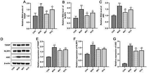 Figure 3. R. chingii treatment inhibited gene expression of TXNIP/NLRP3 pathway in the ovary of PCOS rats. (A-C) TXNIP, NLRP3, and ASC RNA levels were examined using RT-qPCR. (B-E) TXNIP, NLRP3, and ASC protein levels were examined by western blot. β-actin is a loading control. **p < 0.01 vs. control, #p < 0.05 vs. PCOS, ##p < 0.01 vs. PCOS.