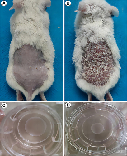 Figure 4 The well-established psoriasis-like in vivo and in vitro models in our previous experiments. Normal mouse (A), psoriasis-like mouse model (B), normal three-dimensional skin model (C) and psoriasis-like three-dimensional skin model (D).