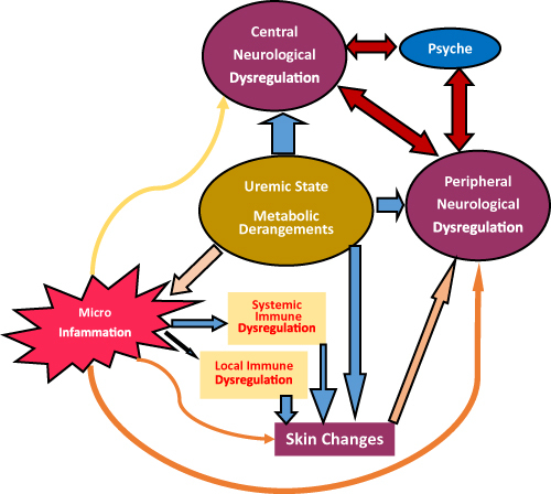 Figure 2 Pathogenic factors of CKD-aP and their interactions.