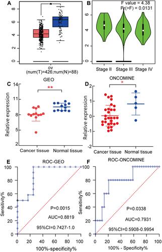 Figure 1 Analysis of differential expression, disease progression and diagnostic implications of ARRDC3 in ovarian cancer. (A and B) Differential expression and disease progression of ARRDC3 in ovarian cancer, respectively; (C and D) validation of differential expression of ARRDC3 in GEO and ONCOMINE databases, respectively; (E and F) diagnostic implications of ARRDC3 in GEO and ONCOMINE databases, respectively.