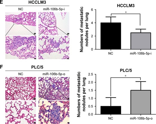 Figure 2 miR-106b-5p promotes human HCC metastasis in vitro and in vivo.