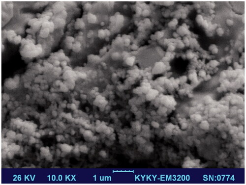 Figure 1. SEM micrograph of HA nanoparticles.