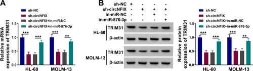 Figure 6. CircNFIX regulated TRIM31 expression by miR-876-3p. (A and B) The expression of TRIM31 in HL-60 and MOLM-13 cells transfected with sh-circNFIX, sh-circNFIX + in-miR-876-3p or corresponding controls (sh-NC or sh-circNFIX + in-miR-NC) was detected by qRT-PCR and western blot assays. **P < 0.01, ***P < 0.001.