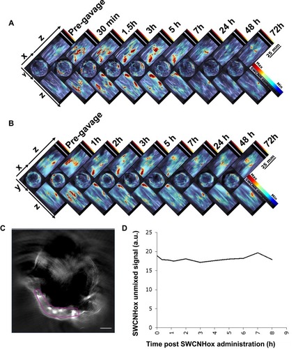 Figure 4 Multi-intensity projection (MIP) of orthogonal views of 3D data obtained by MSOT at scheduled time points pre- and post-oral administration of SWCNHox in mice. (A) Mouse was administered a single dose of 200 µg SWCNHox via oral gavage and imaged before and after the administration. (B) Mouse was orally administered with multiple doses (50 µg SWCNHox per dose and four doses in total) and imaged before and after the fourth administration. The mice were kept under anesthesia during the measurement. (C) Picture of ROI selection. (D) The SWCNHox signals over time in vessels after oral gavage administration of single-dose 200 µg of SWCNHox.