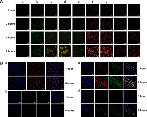 Figure 6 (A) The cellular uptake analyzed by fluorescence microscopy. a) FITC, b) FITC-labeled SWCNTs-HA, c) FITC-labeled SWCNTs-HA-ss-DOX, d) FITC-labeled Gd/SWCNTs-HA-ss-DOX, e) FITC-labeled Gd/SWCNTs-HA-DOX, f) SWCNTs-HA-ss-DOX, g) Gd/SWCNTs-HA-ss-DOX, h) Gd/SWCNTs-HA-DOX, and i) free DOX. (B) The intracellular distribution in MCF-7 cells analyzed by confocal microscopy. a) free DOX, b) free-HA pretreated Gd/SWCNTs-HA-ss-DOX, c) Gd/SWCNTs-HA-ss-DOX, and d) Gd/SWCNTs-HA-DOX.Abbreviations: DOX, doxorubicin; FITC, fluorescein isothiocyanate; Gd, gadolinium; HA, hyaluronic acid; MCF-7, Michigan Cancer Foundation-7; SWCNTs, single-walled carbon nanotubes.