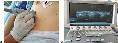 Fig. 1 Ultrasound measurement of diaphragmatic displacement. a. ultrasound probe placement. b. 2D and M-mode ultrasonography of right hemidiaphragm.