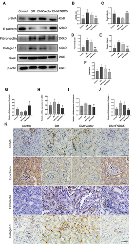 Figure 6 Irisin restrained renal tubular EMT and TIF in diabetic mice. (A–F) Expressions and measurements of α-SMA, E-cadherin, Fibronectin, Collagen 1 and Snail, respectively, at the protein and RNA levels.(G–J) RT-qPCR was used to ascertain the mRNA levels of E-cadherin, α-SMA, Fibronectin and Collagen 1. (K) Immunohistochemical staining results of α-SMA, E-cadherin, Fibronectin and Collagen 1 (scale bar, 50 μm) in different groups of renal sections. Each experiment was carried out separately and at least three times. Values are expressed as mean ± SD. *p < 0.05 vs Control group, **p < 0.01 vs Control group, ***p < 0.001 vs Control group, ##p < 0.01 vs DM group, ###p < 0.001 vs DM group.