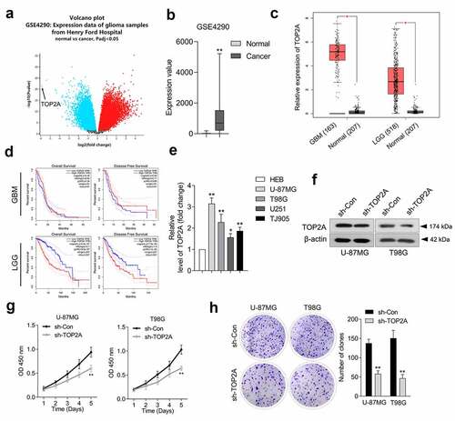 Figure 1. TOP2A is overexpressed in glioma tissues and cells. (a) We analyzed differentially expressed genes in GSE4290 microarray dataset. Volcano plot of significant differentially expressed genes with |logFC|> 2 and P < 0.05. (b) The abnormal TOP2A expression was presented as box-plot diagram. (c) TOP2A expression was elevated in glioblastoma (GBM) and low-grade glioma (LGG) compared with normal using TCGA database (https://tcga-data.nci.nih.gov/tcga/). (d) Upper panel: Kaplan-Meier analysis of overall survival (OS) and disease-free survival (DFS) in GBM patients with low TOP2A expression (81) and high TOP2A expression (n = 81). Lower panel: Kaplan-Meier analysis of OS and DFS in LGG patients with low TOP2A expression (257) and high TOP2A expression (n = 257). (e) Relative mRNA levels of TOP2A in normal brain glial cell line, HEB and glioma cell lines. (f) TOP2A expressions in U-87 MG and T98G cells transfected with sh-TOP2A were detected using Western blot. (g) The proliferation of sh-TOP2A transfected U-87 MG and T98G cells were determined using CCK-8 assay. (h) Colony formation analysis of glioma cells growth. Data were determined from triplicate experiments (Mean ± SD). **P < 0.01 compared with sh-Con.