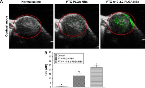 Figure 8 High-frequency resolution US imaging under contrast mode for PTX-PLGA NBs and PTX-A10-3.2-PLGA NBs in xenograft tumors.Notes: (A) Tumor-targeted real-time US imaging in contrast mode (the enhancement is shown in green) in various groups: the normal saline group, PTX-PLGA NBs group, and PTX-A10-3.2-PLGA NBs group. (B) GSI in various groups. Control compared with the other groups, *P<0.05; PTX-A10-3.2-PLGA NBs compared with the other groups, #P<0.05.Abbreviations: GSI, gray-scale intensity; NBs, nanobubbles; PLGA, poly(lactide-co-glycolic acid); PTX, paclitaxel; US, ultrasound.