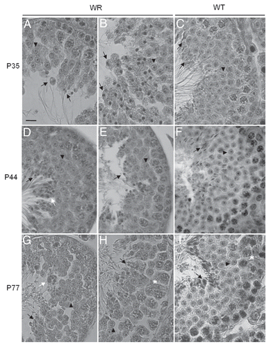 Figure 2 Histology of 35 (A–C), 44 (D–F) and 77 (G–I) days-old testis. Representative cross sections of the seminiferous epithelium of wr (left and middle columns) and wild-type (right column) mice. Black arrowheads and arrows point to round spermatids and elongated spermatids/spermatozoa, respectively. White arrows point to the clumping of round-headed spermatozoa next to be released (D) and to aggregates of residual bodies containing clumped spermatids (G). Asterisk signs the loosening/loss of Sertoli-germ cell contacts at the basal compartment in wr (H) versus wild type littermate (I). Note the round heads/nuclei and vacuolated cytoplasm of wr spermatids/spermatozoa in contrast to the hook-shaped heads devoid of remnants of cytoplasm of the wild-types. Scale bar, 10 µm.