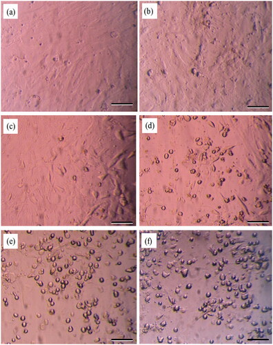 Figure 4. Representative phase-contrast microscopy images demonstrating the morphological characteristics of MSCs (a) and MSCs treated with vinblastine concentration of 50 μM (b), 100 μM (c), 150 μM (d), 200 μM (e), 250 μM (f). Scale bars: 100 μm.
