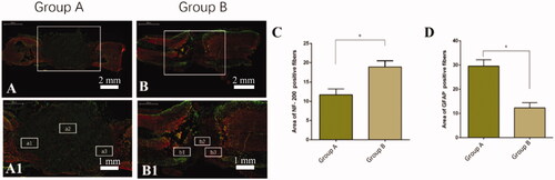 Figure 5. Double immunostaining of the site of injury of spinal cords for astrocytes (GFAP, green) and axons (neurofilament-200, NF-200, red). Compared with BMSCs seeded on the non-nanofibrous SF scaffold (Group A), the BMSC-seeded nanofibrous SF scaffold (Group B) displayed lower positive glial area and higher NF positive axons. Comparison of the fluorescence area of NF-200 positive fibres (C) and GFAP positive area (D) in the rostral (a1, b1), centre (a2, b2), and caudal (c1, c2) of the injury/scaffold site. Difference was considered statistically significant when *p < 0.05.